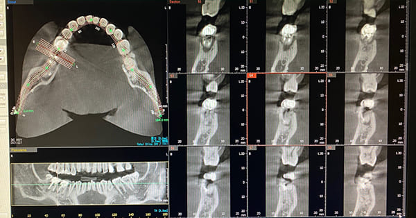 精密なCT画像で診断