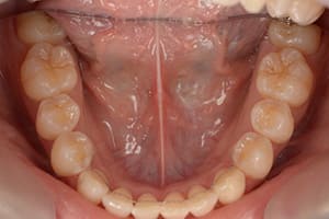 開咬・オープンバイト 治療後下顎咬合面