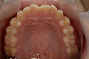 開咬・オープンバイト 治療前上顎咬合面