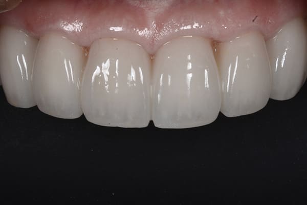 矯正歯科治療で、歯の寿命を、笑顔の未来を